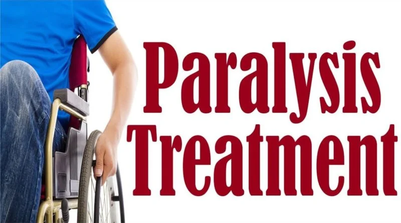 Paralysis Treatment in Rohini