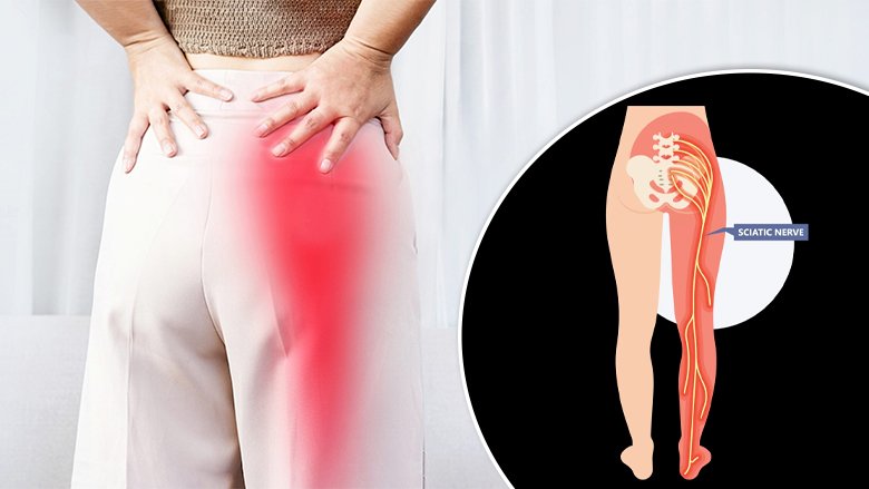 Best Sciatic Nerve Injury Treatment in Rohini